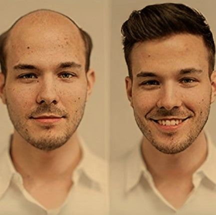 Kunde vorher und nachher mit dem Thin Skin 0.03