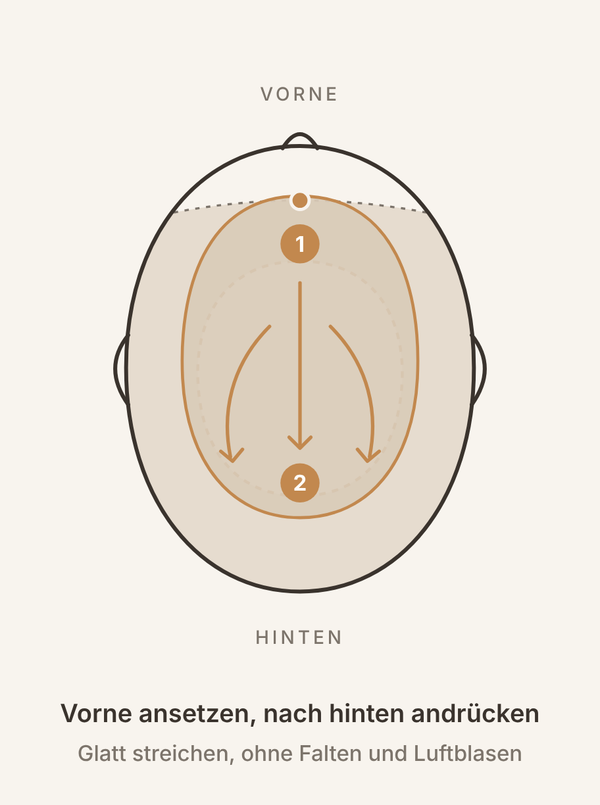 Haarsystem befestigen