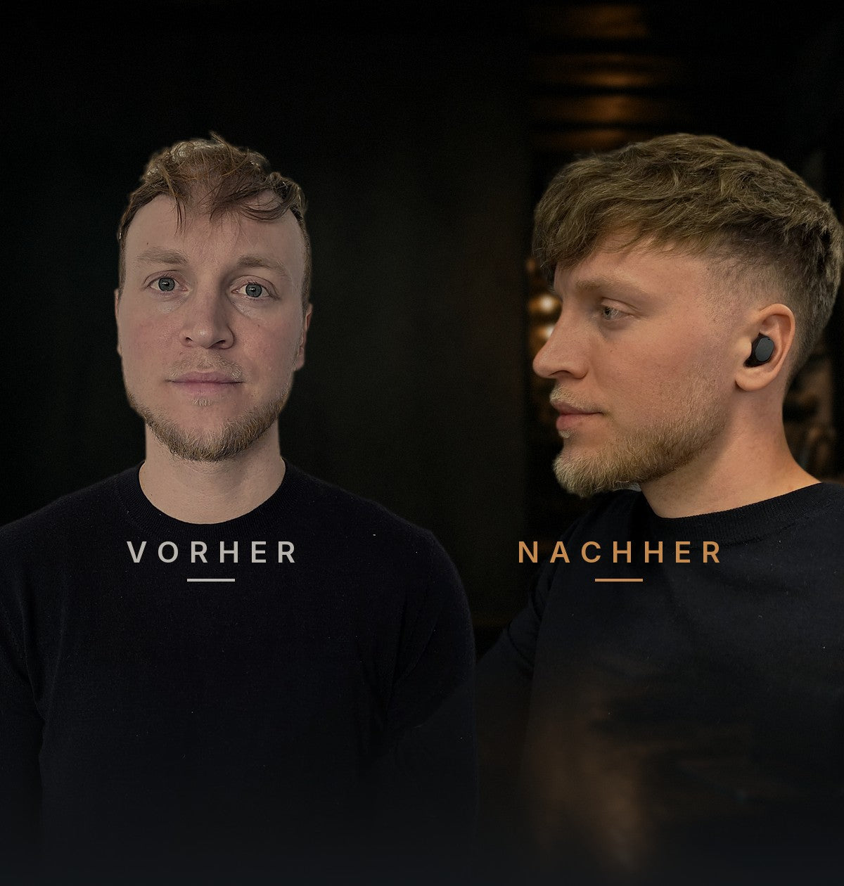 Kunde vorher und nachher mit Haarsystem